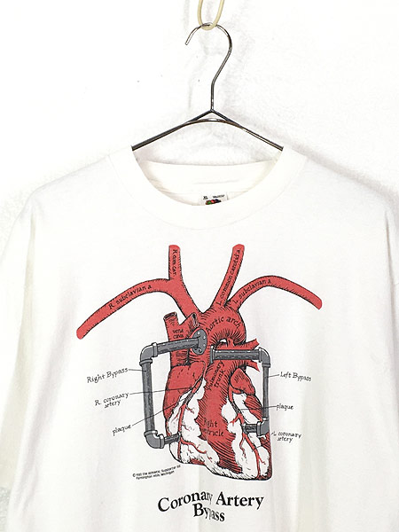 古着 80s Usa製 Coronary Artery 静脈 パイパス 臓器 だまし絵 アート Tシャツ Xl 古着 古着 通販 ヴィンテージ古着屋のドラセナ