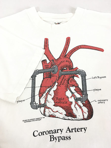 古着 80s Usa製 Coronary Artery 静脈 パイパス 臓器 だまし絵 アート Tシャツ Xl 古着 古着 通販 ヴィンテージ古着屋のドラセナ